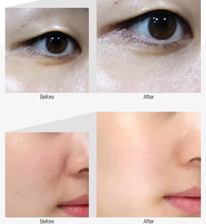 MEDI-PEEL - Mezzo Filla Eye Serum