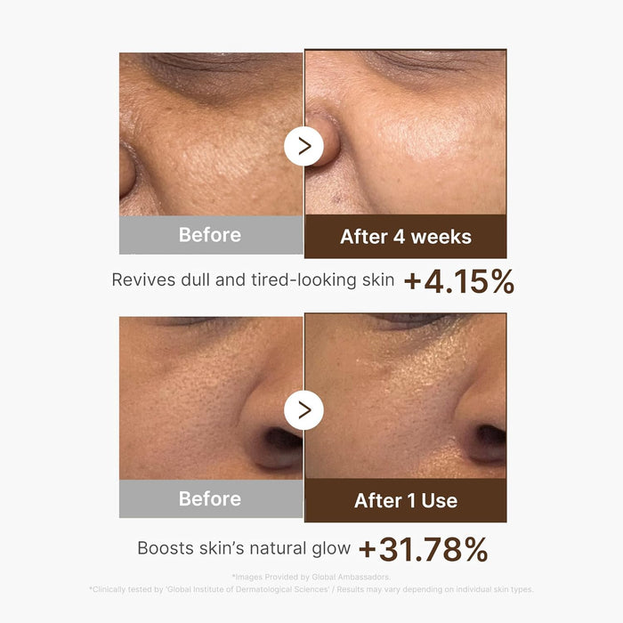 MEDICUBE - Deep Vitamin C Capsule Serum