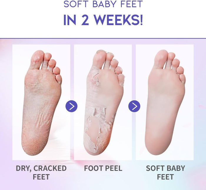 #OOTD - Lavender Therapy Foot Peel Mask